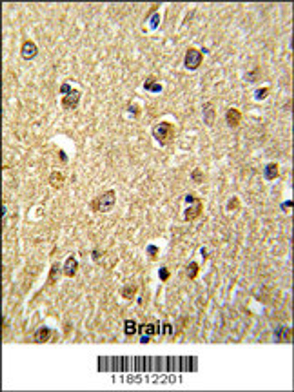 Formalin-fixed and paraffin-embedded human brain reacted with NKRF Antibody, which was peroxidase-conjugated to the secondary antibody, followed by DAB staining.