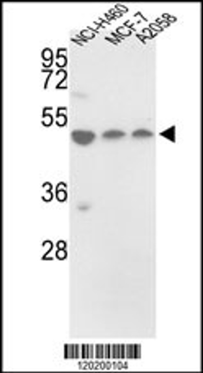 Western blot analysis of in NCI-H460, MCF-7, A2058 cell line lysates (35ug/lane)