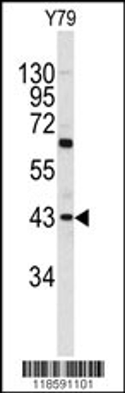 Western blot analysis of PRELP antibody in Y79 cell line lysates (35ug/lane)