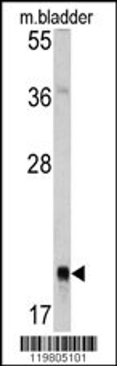 Western blot analysis of RAB13 antibody in mouse bladder tissue lysates (35ug/lane)