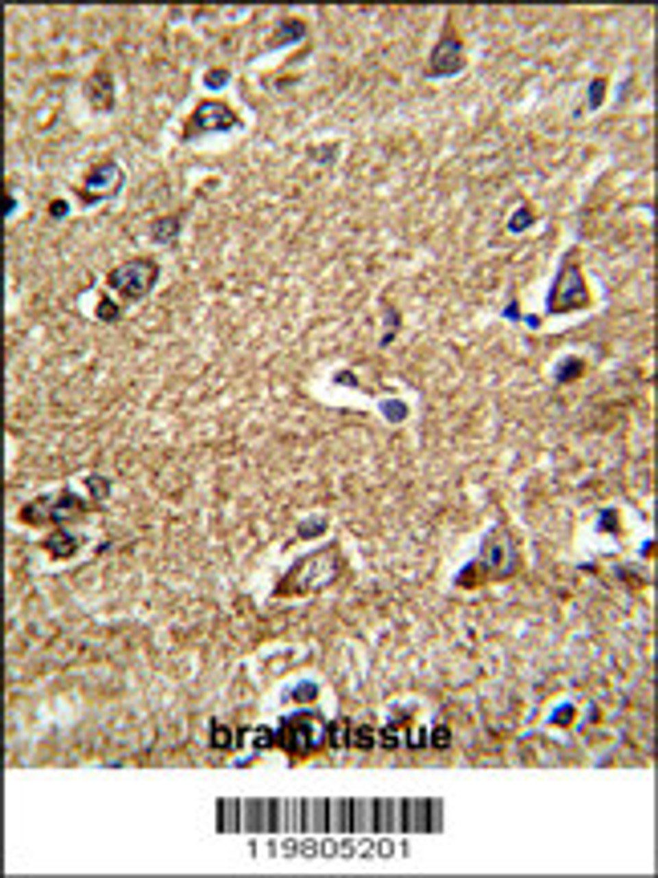 Formalin-fixed and paraffin-embedded human brain tissue reacted with RAB13 Antibody, which was peroxidase-conjugated to the secondary antibody, followed by DAB staining.