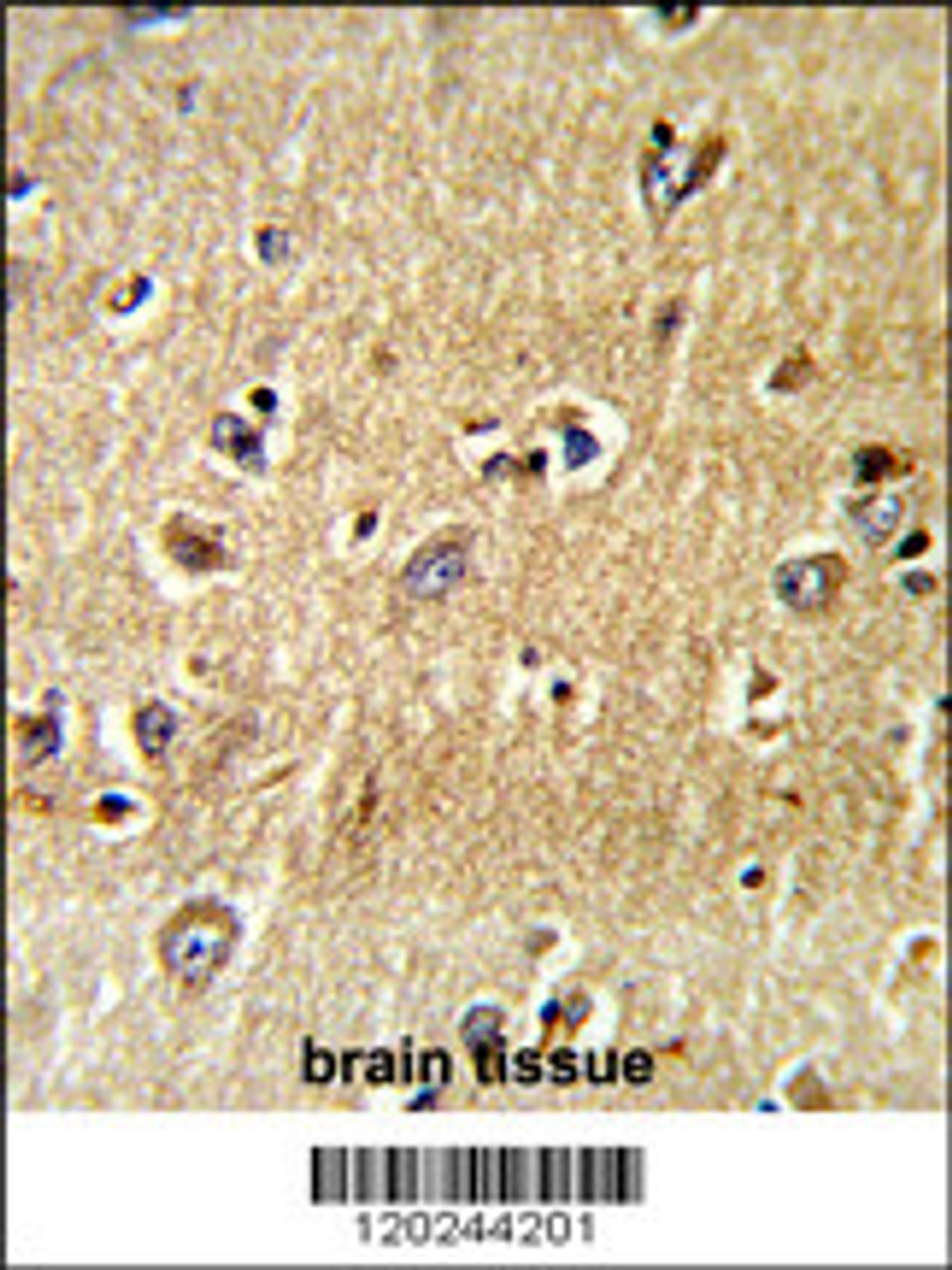 Formalin-fixed and paraffin-embedded human brain tissue reacted with SCFD1 Antibody, which was peroxidase-conjugated to the secondary antibody, followed by DAB staining.