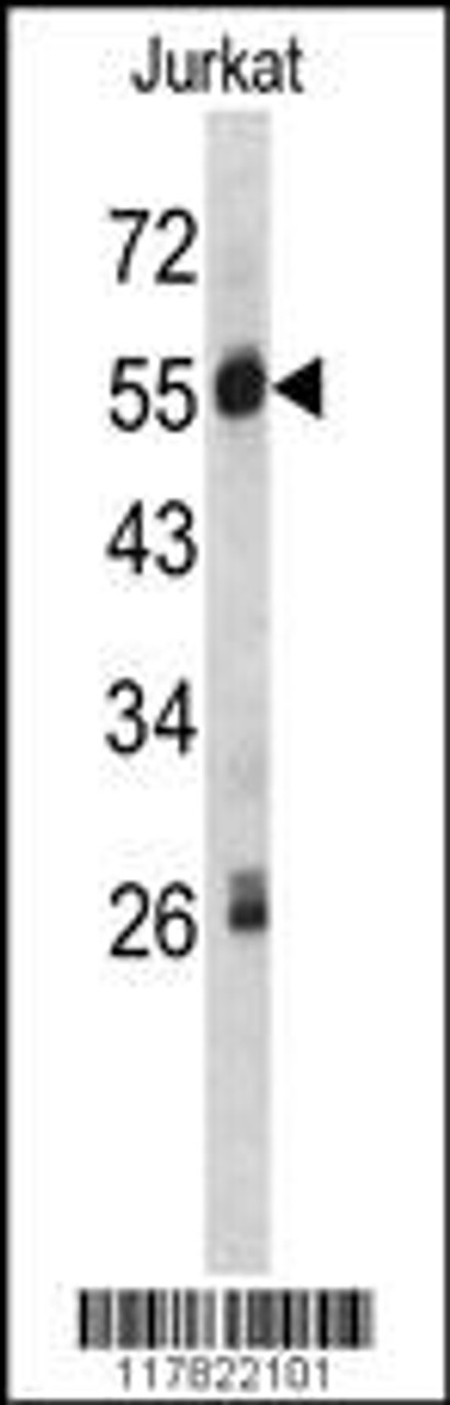 Western blot analysis of SERPING1 antibody in Jurkat cell line lysates (35ug/lane)