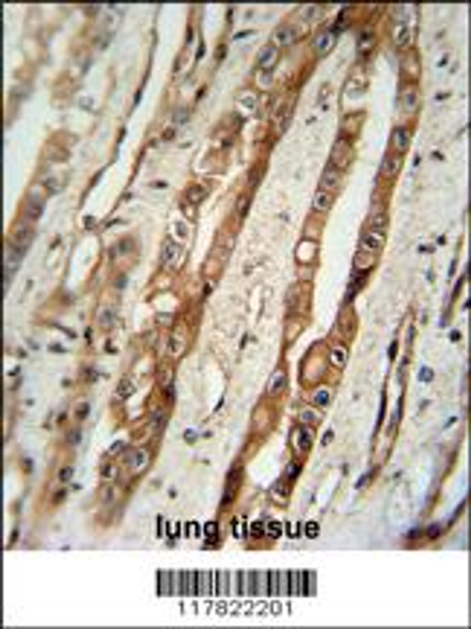 SERPING1 Antibody immunohistochemistry analysis in formalin fixed and paraffin embedded human lung tissue followed by peroxidase conjugation of the secondary antibody and DAB staining.