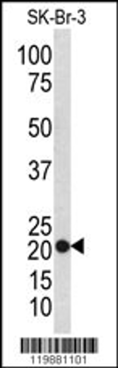 Western blot analysis of TAGLN antibody in SK-Br-3 cell line lysates (35ug/lane)