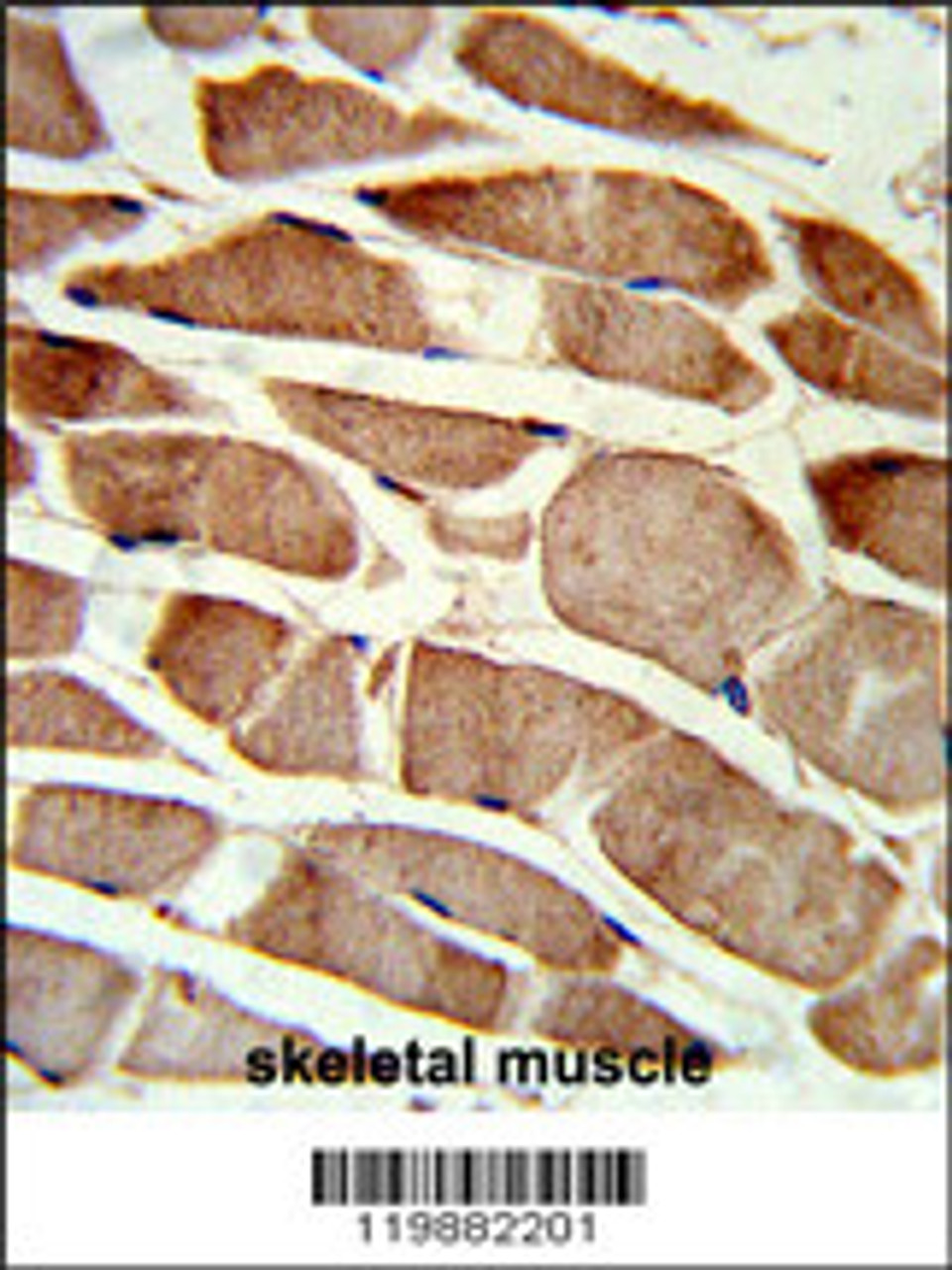 Formalin-fixed and paraffin-embedded human skeletal muscle reacted with TAGLN Antibody, which was peroxidase-conjugated to the secondary antibody, followed by DAB staining.