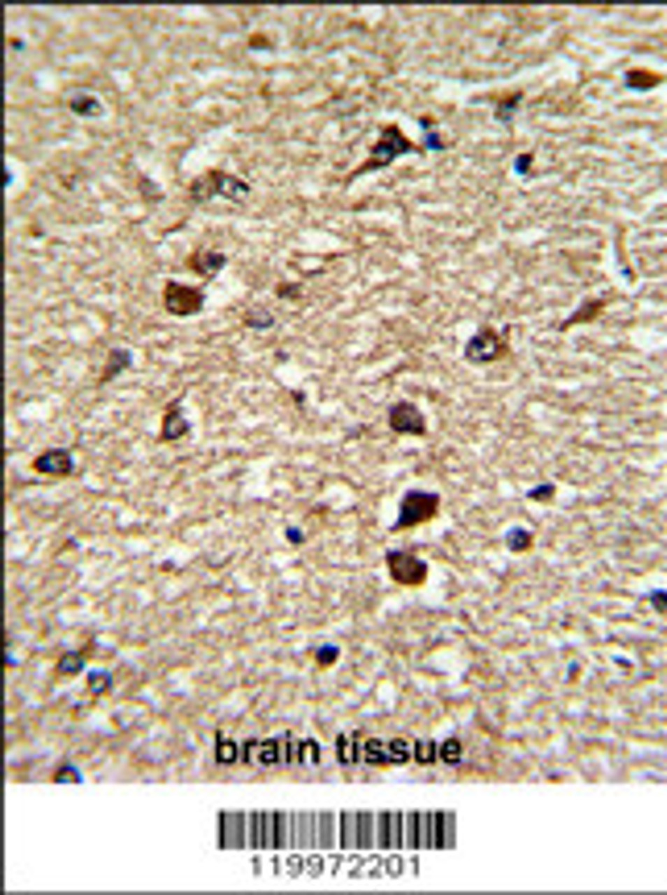 Formalin-fixed and paraffin-embedded human brain tissue reacted with XPO1 Antibody, which was peroxidase-conjugated to the secondary antibody, followed by DAB staining.