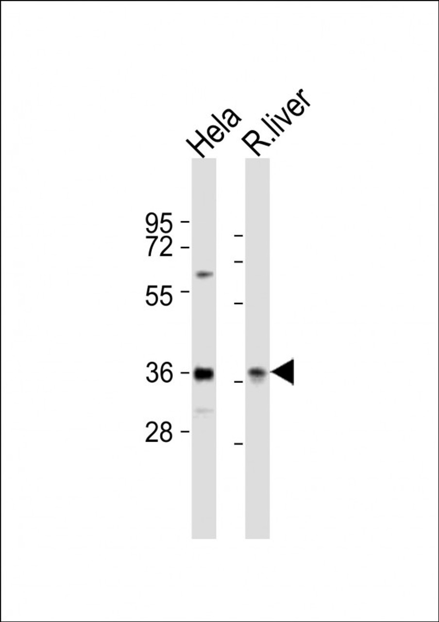 Western Blot at 1:2000 dilution Lane 1: Hela whole cell lysates Lane 2: rat liver lysates Lysates/proteins at 20 ug per lane.