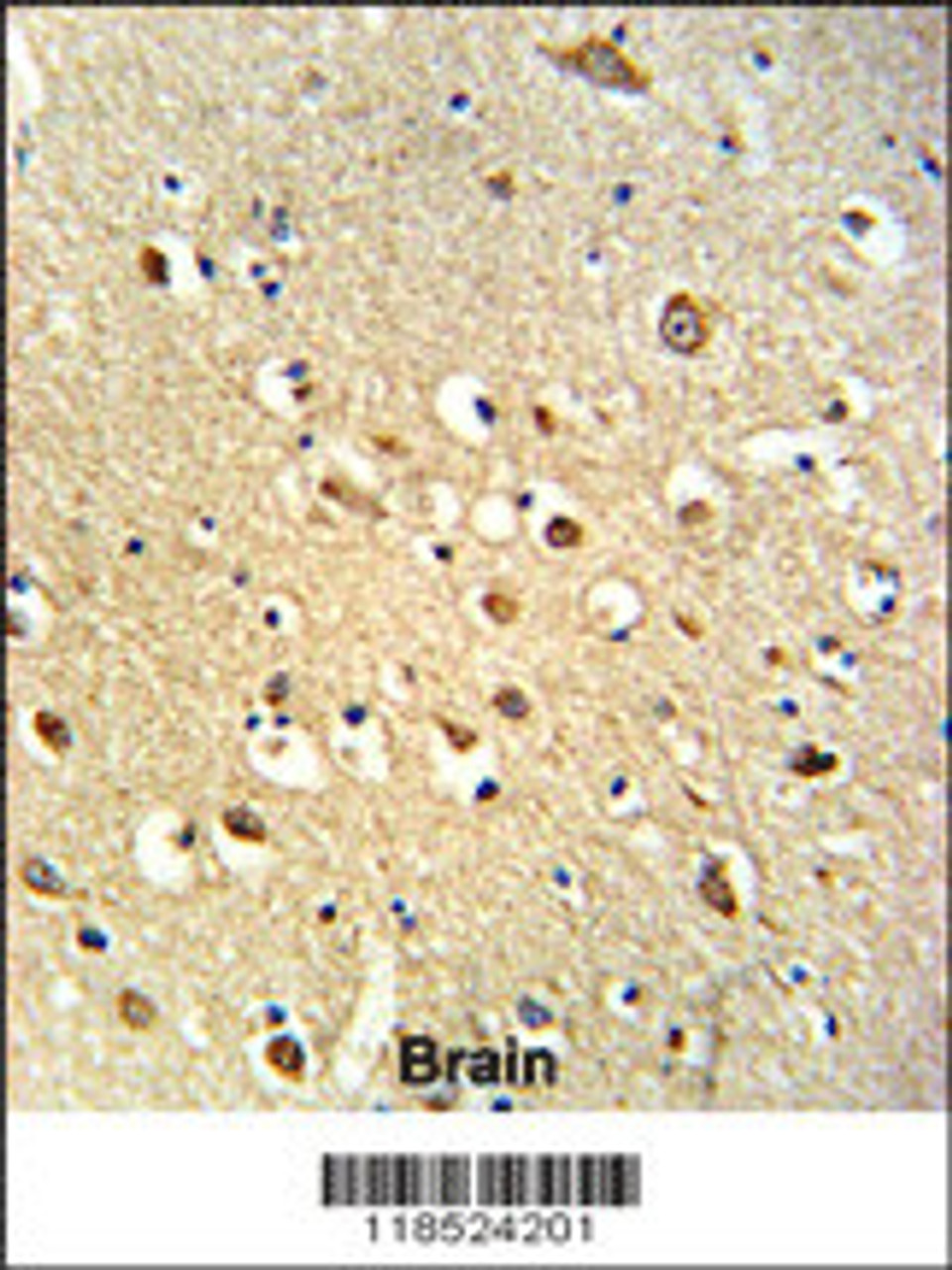 Formalin-fixed and paraffin-embedded human brain tissue reacted with OGT Antibody, which was peroxidase-conjugated to the secondary antibody, followed by DAB staining.