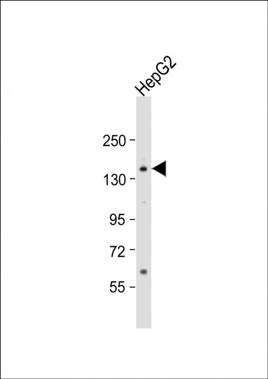 Western Blot at 1:1000 dilution + HepG2 whole cell lysate Lysates/proteins at 20 ug per lane.