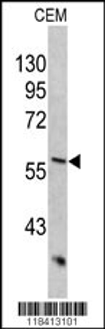 Western blot analysis of KRT10 antibody in CEM cell line lysates (35ug/lane)
