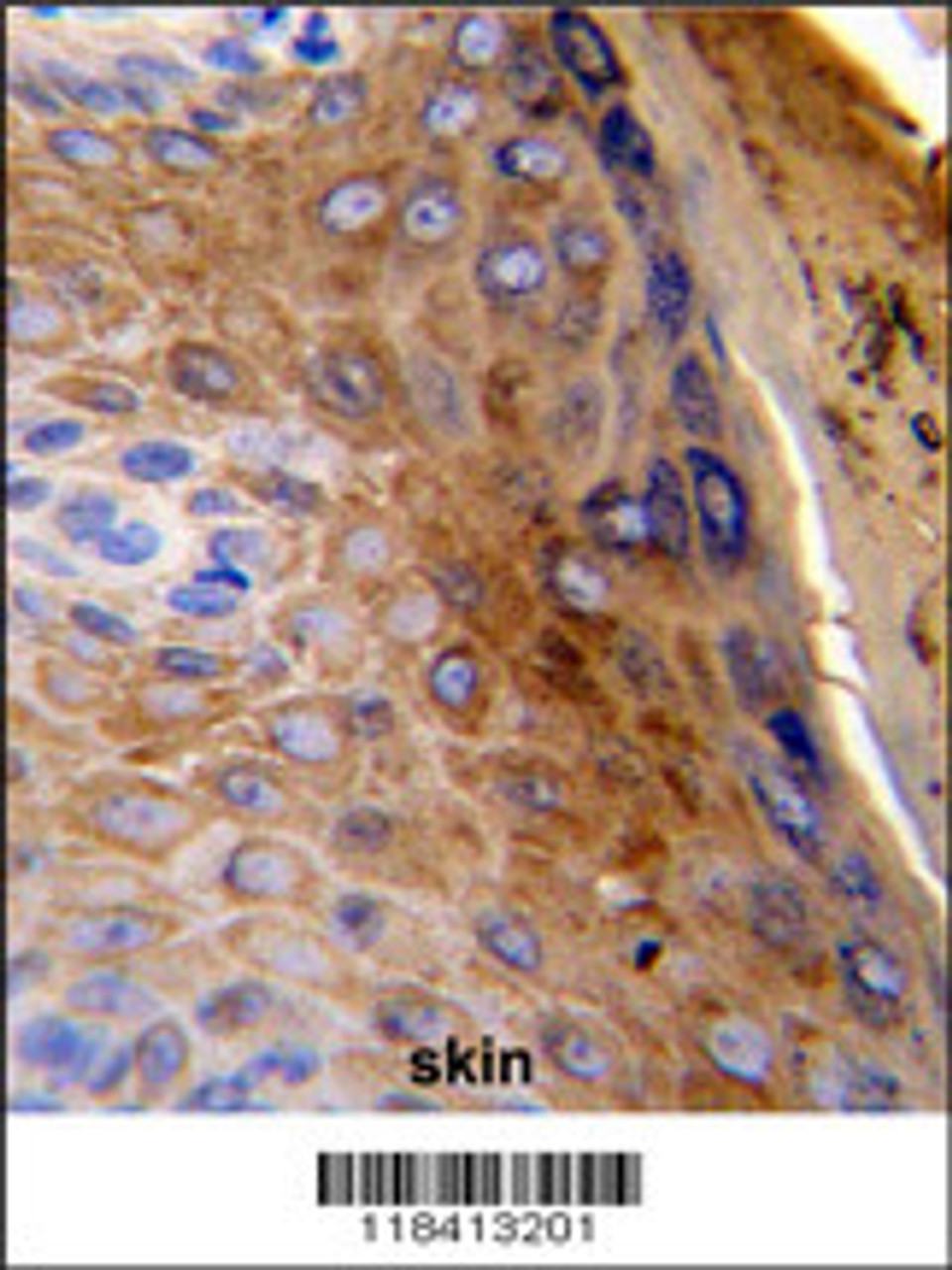 Formalin-fixed and paraffin-embedded human skin reacted with KRT10 Antibody, which was peroxidase-conjugated to the secondary antibody, followed by DAB staining.