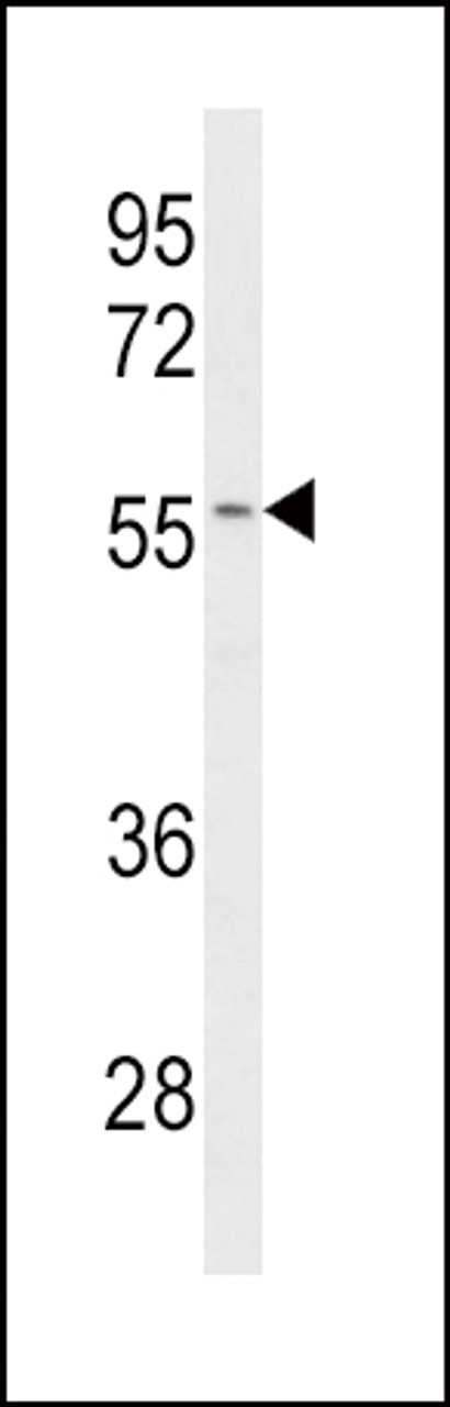 Western blot analysis of CYP2C19 Antibody in Jurkat cell line lysates (35ug/lane)