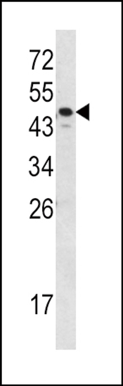 Western blot analysis of SERPINA7 Antibody in MDA-MB231 cell line lysates (35ug/lane)