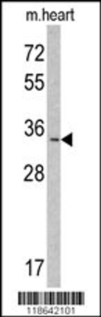 Western blot analysis of MLF1 Antibody in mouse heart tissue lysates (35ug/lane)