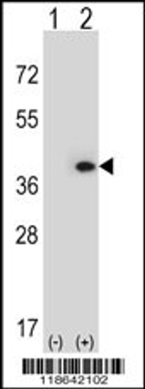 Western blot analysis of MLF1 using rabbit polyclonal MLF1 Antibody using 293 cell lysates (2 ug/lane) either nontransfected (Lane 1) or transiently transfected (Lane 2) with the MLF1 gene.
