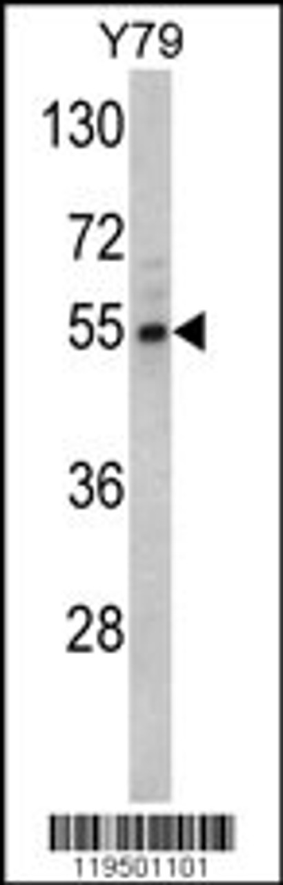 Western blot analysis of Fascin Antibody in Y79 cell line lysates (35ug/lane)