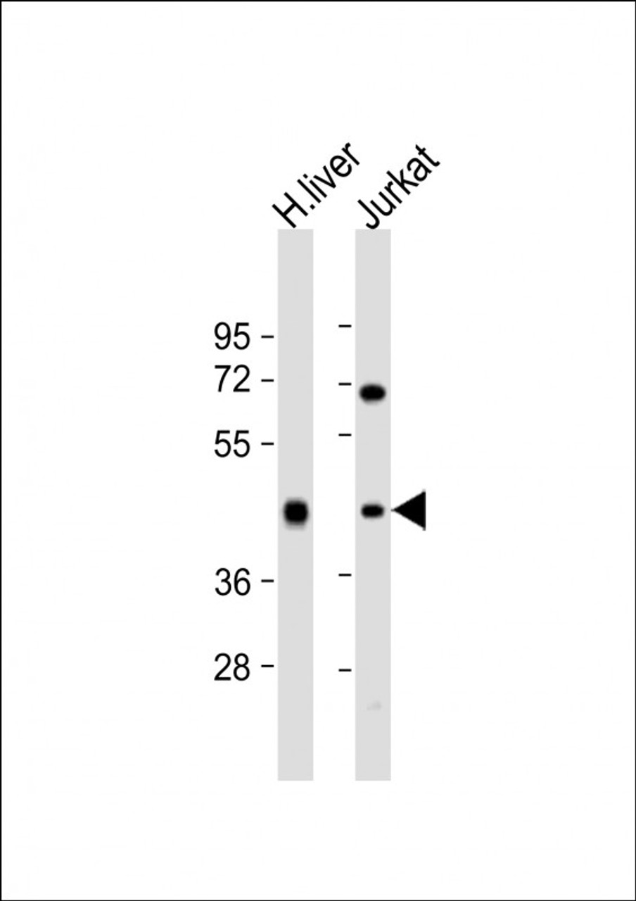 Western Blot at 1:2000 dilution Lane 1: human liver lysate Lane 2: Jurkat whole cell lysate Lysates/proteins at 20 ug per lane.