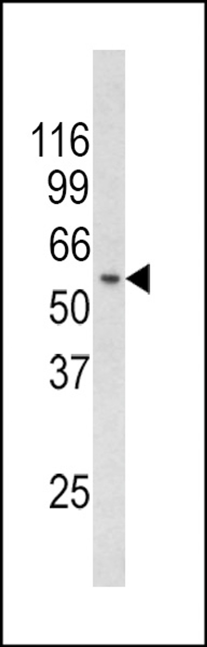 Western blot analysis of CHC1L Antibody in mouse thymus tissue lysates (35ug/lane)