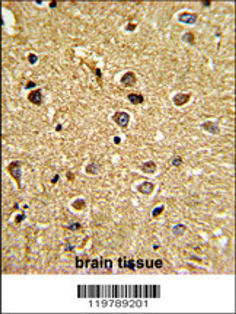 Formalin-fixed and paraffin-embedded human brain tissue reacted with CHC1L Antibody (N-term) , which was peroxidase-conjugated to the secondary antibody, followed by DAB staining.