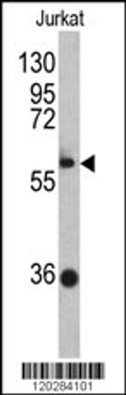 Western blot analysis of ZBTB2 antibody in Jurkat cell line lysates (35ug/lane)