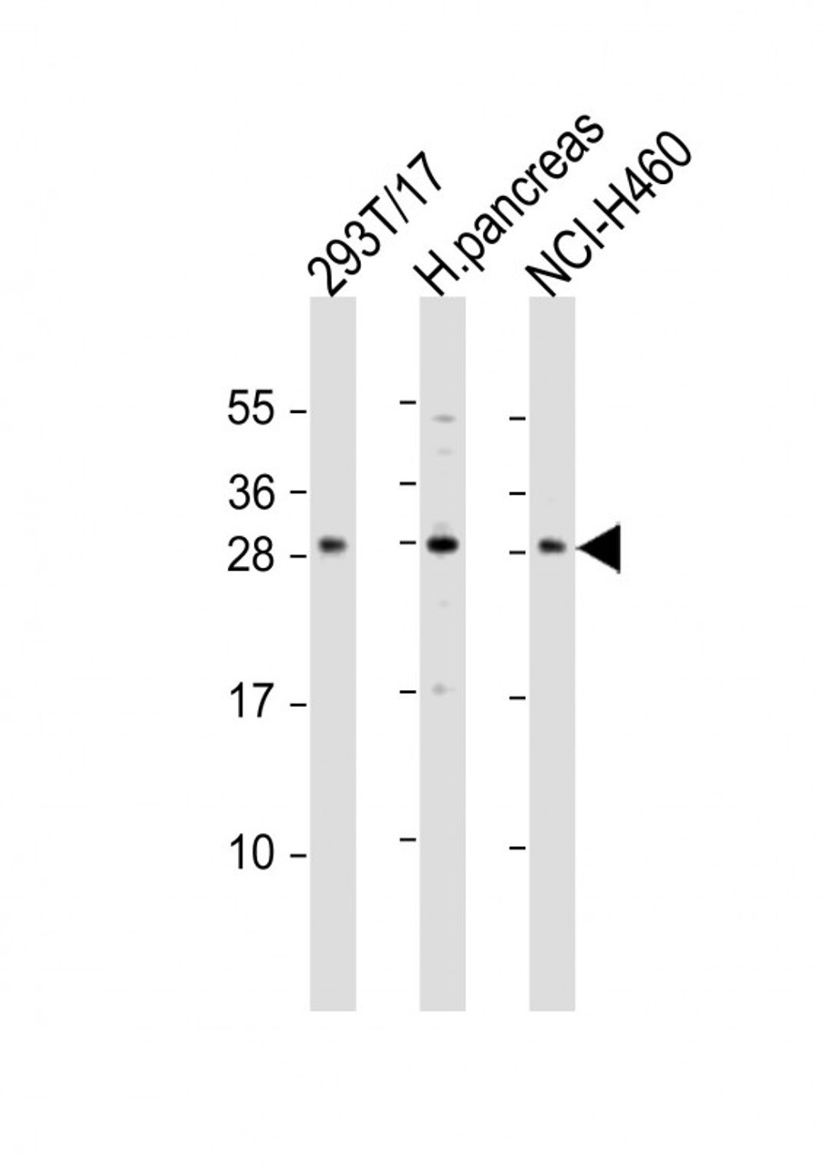 Western Blot at 1:1000 dilution Lane 1: 293T/17 whole cell lysate Lane 2: human pancreas lysate Lane 3: NCI-H460 whole cell lysate Lysates/proteins at 20 ug per lane.