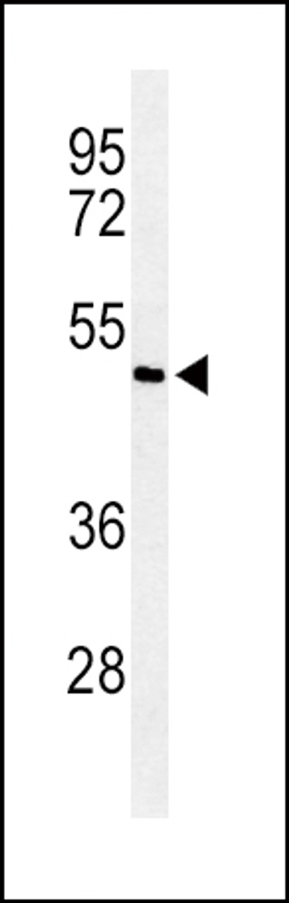 Western blot analysis of Smad7 Antibody in ZR-75-1 cell line lysates (35ug/lane)
