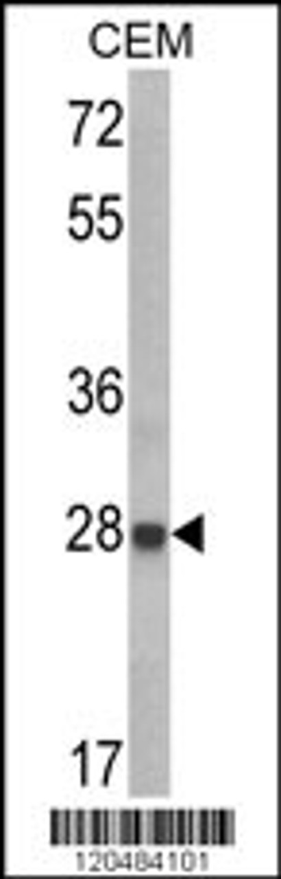 Western blot analysis of IGFBP6 Antibody in CEM cell line lysates (35ug/lane)