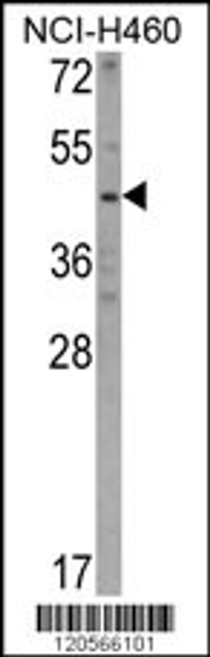 Western blot analysis of KYNU Antibody in NCI-H460 cell line lysates (35ug/lane)