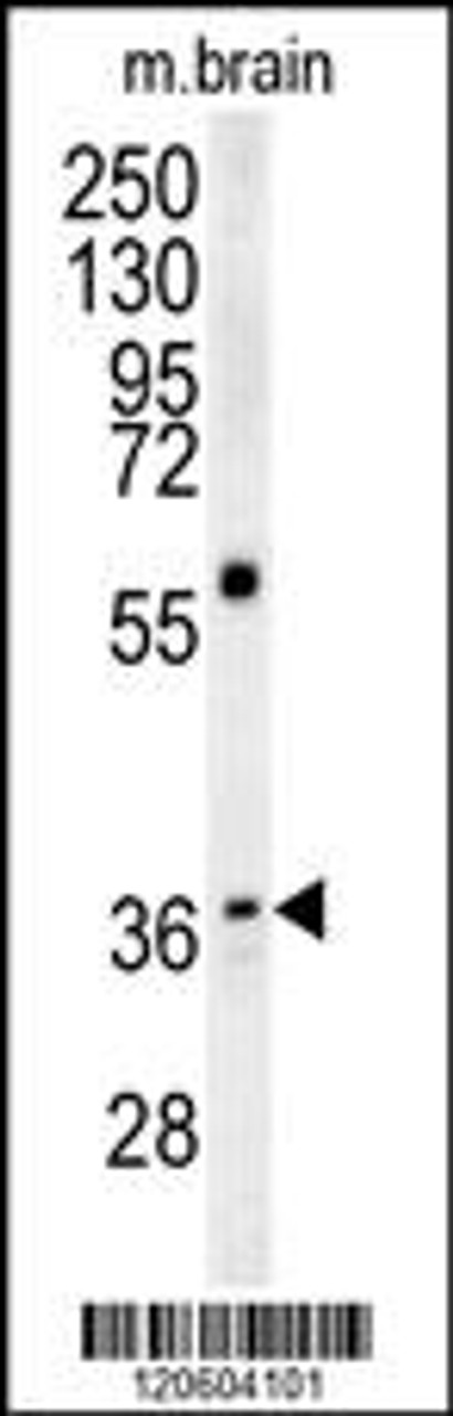 Western blot analysis in mouse brain tissue lysates (15ug/lane) .This demonstrates the detected MAPRE1 protein (arrow) .