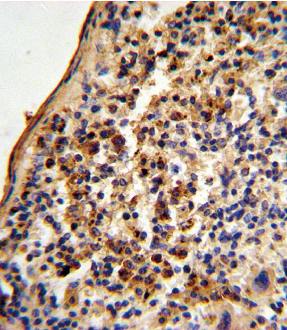 Formalin-fixed and paraffin-embedded mouse spleen tissue reacted with Ku70 Antibody, which was peroxidase-conjugated to the secondary antibody, followed by DAB staining.