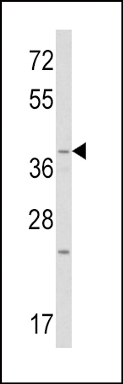 Western blot analysis of WNT1 Antibody in mouse heart tissue lysates (35ug/lane)