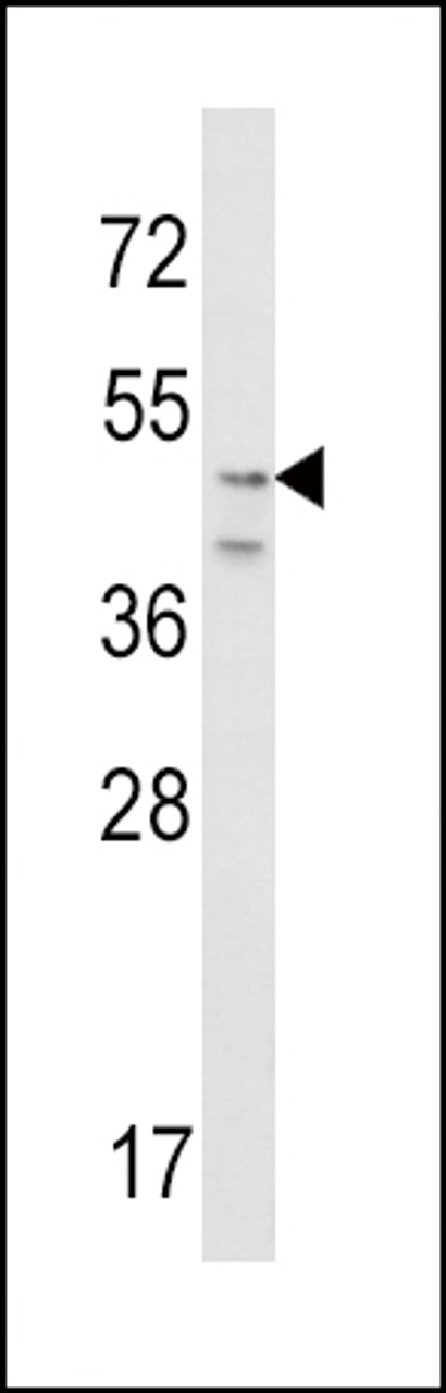 Western blot analysis of CRHR2 Antibody in NIH-3T3 cell line lysates (35ug/lane)