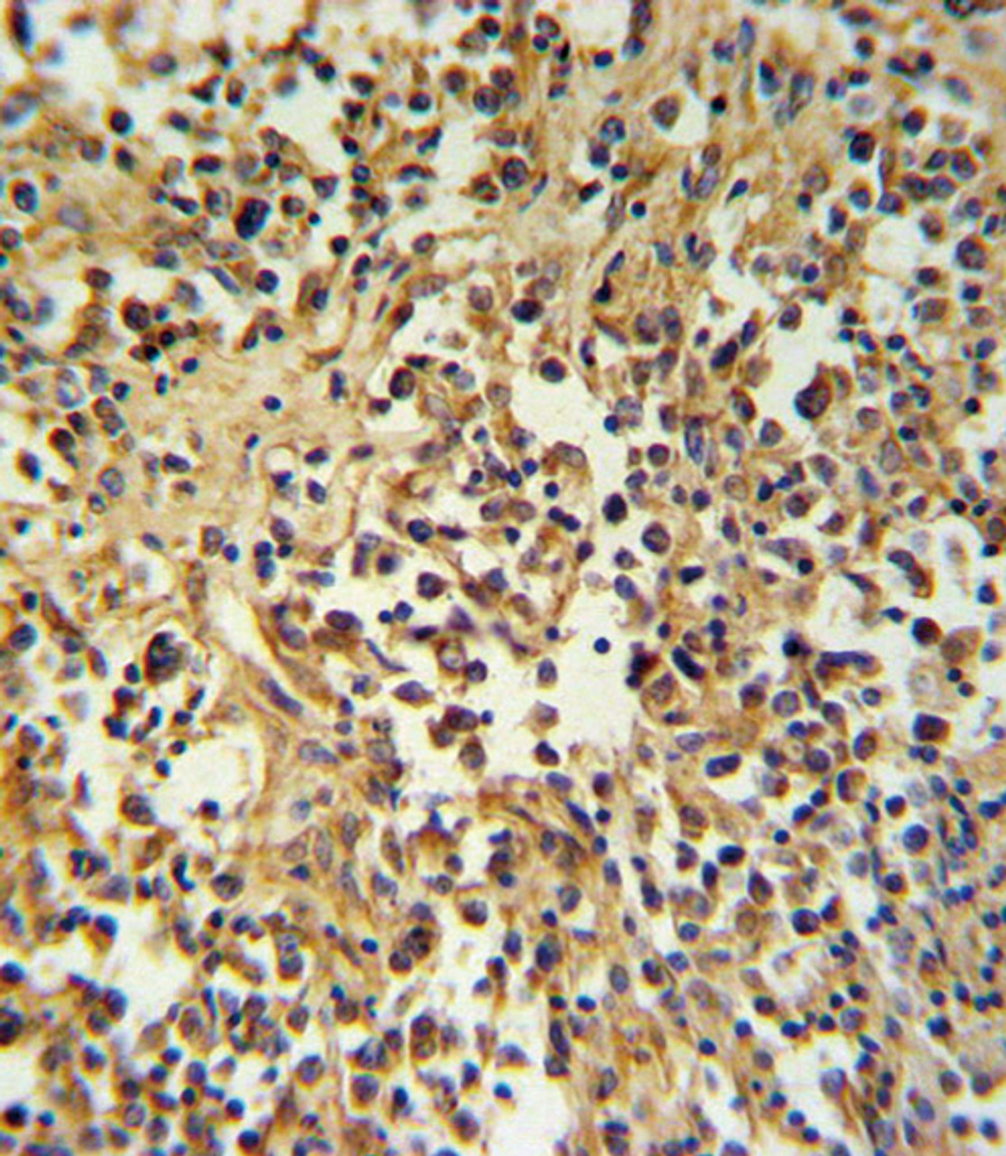 GZMM Antibody IHC analysis in formalin fixed and paraffin embedded human lymph tissue followed by peroxidase conjugation of the secondary antibody and DAB staining.