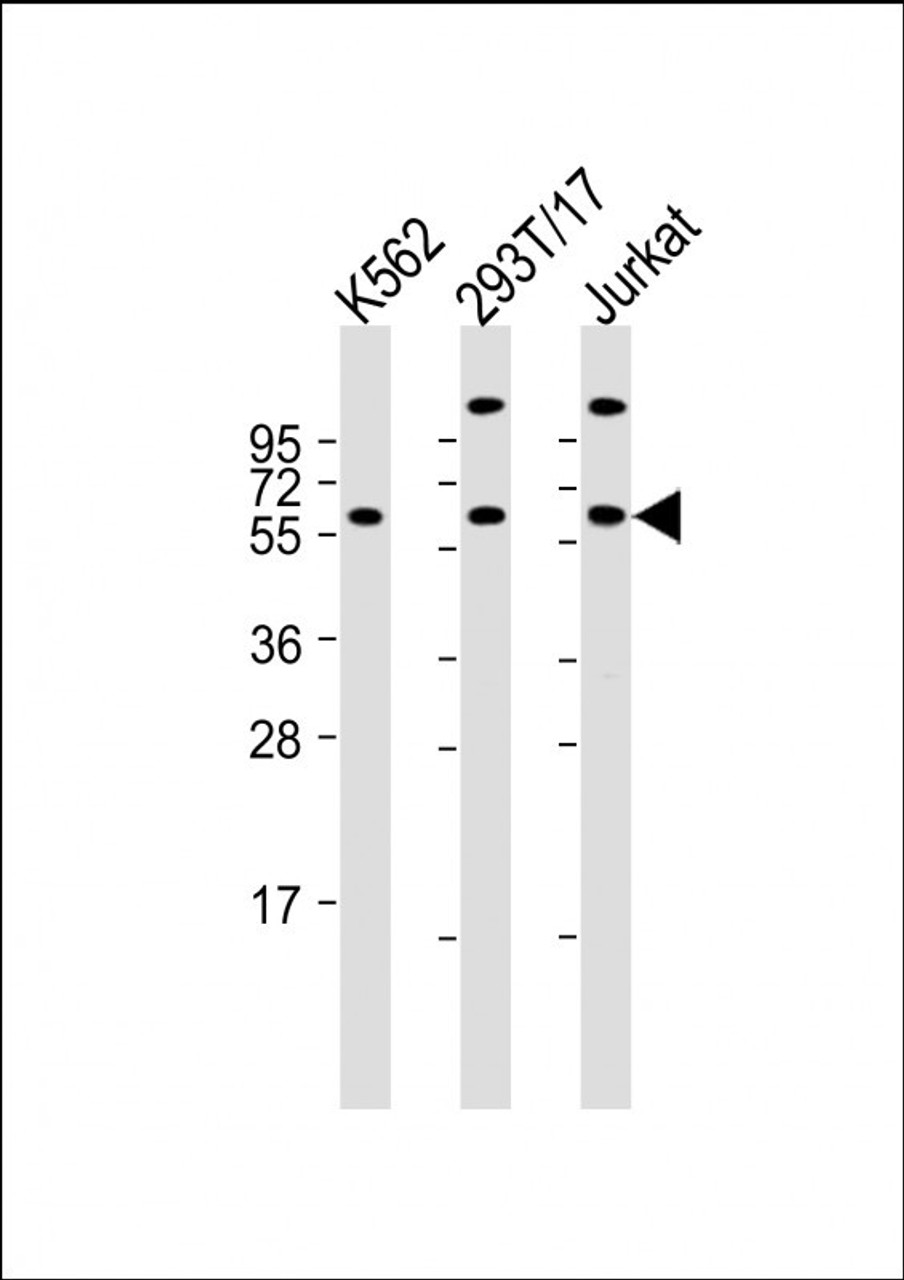Western Blot at 1:2000 dilution Lane 1: K562 whole cell lysate Lane 2: 293T/17 whole cell lysate Lane 3: Jurkat whole cell lysate Lysates/proteins at 20 ug per lane.