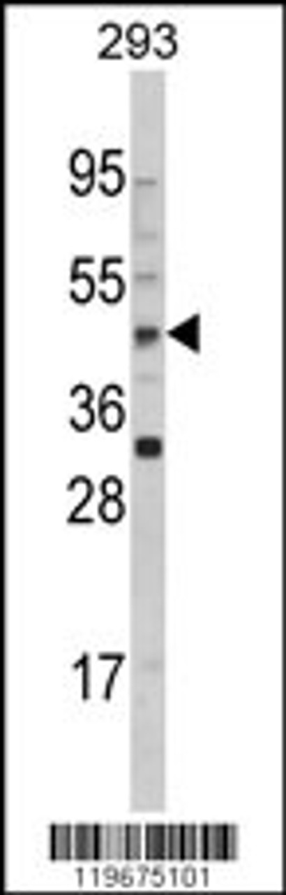 Western blot analysis of AADAC Antibody in 293 cell line lysates (35ug/lane)