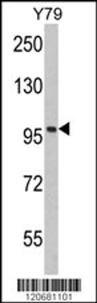 Western blot analysis of KPNB1 Antibody in Y79 cell line lysates (35ug/lane)