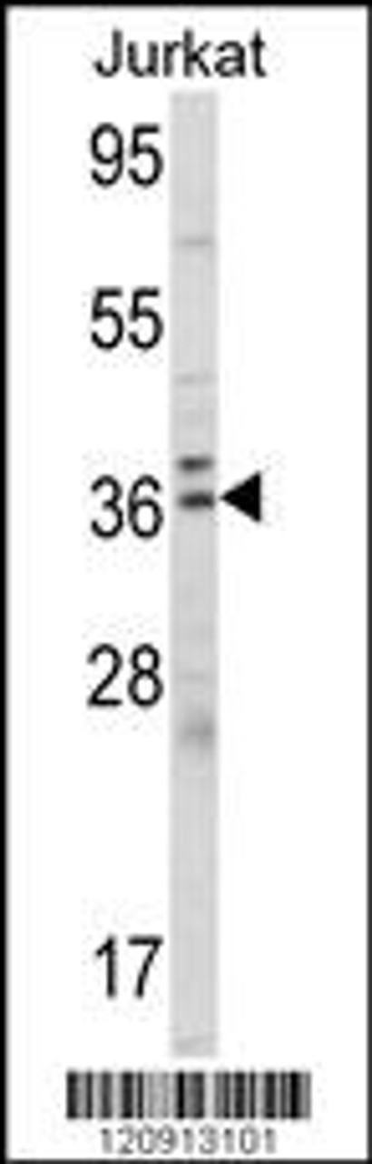Western blot analysis of ALAD Antibody in Jurkat cell line lysates (35ug/lane)
