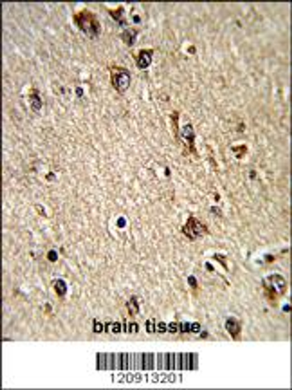 Formalin-fixed and paraffin-embedded human brain tissue reacted with ALAD Antibody, which was peroxidase-conjugated to the secondary antibody, followed by DAB staining.