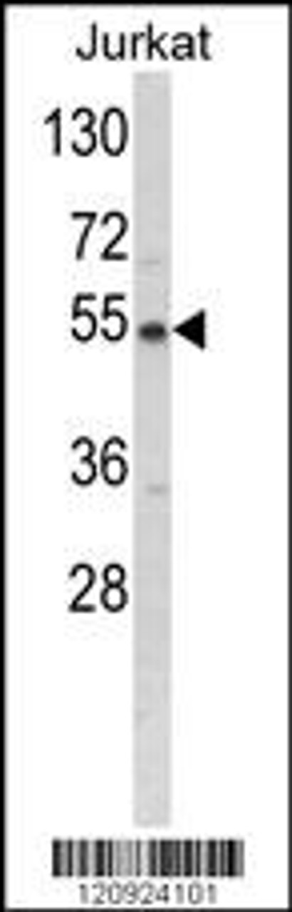 Western blot analysis of BCKDHA Antibody in Jurkat cell line lysates (35ug/lane)