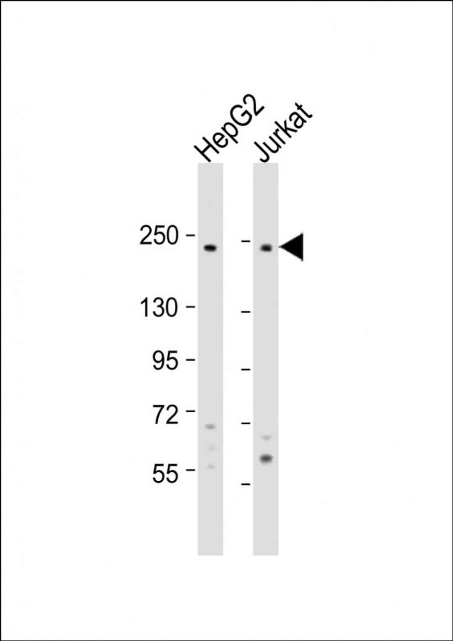 Western Blot at 1:1000 dilution Lane 1: HepG2 whole cell lysate Lane 2: Jurkat whole cell lysate Lysates/proteins at 20 ug per lane.