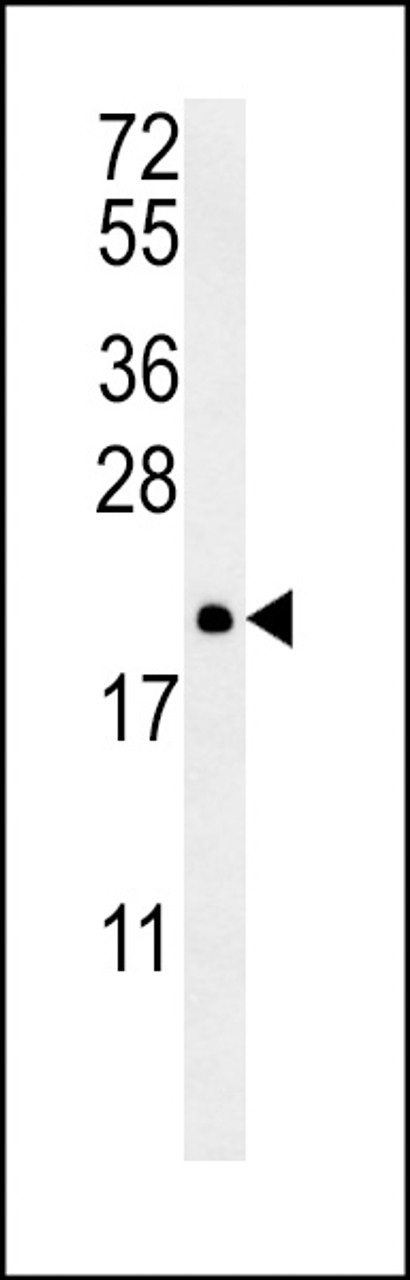 Western blot analysis in NCI-H460 cell line lysates (35ug/lane) .