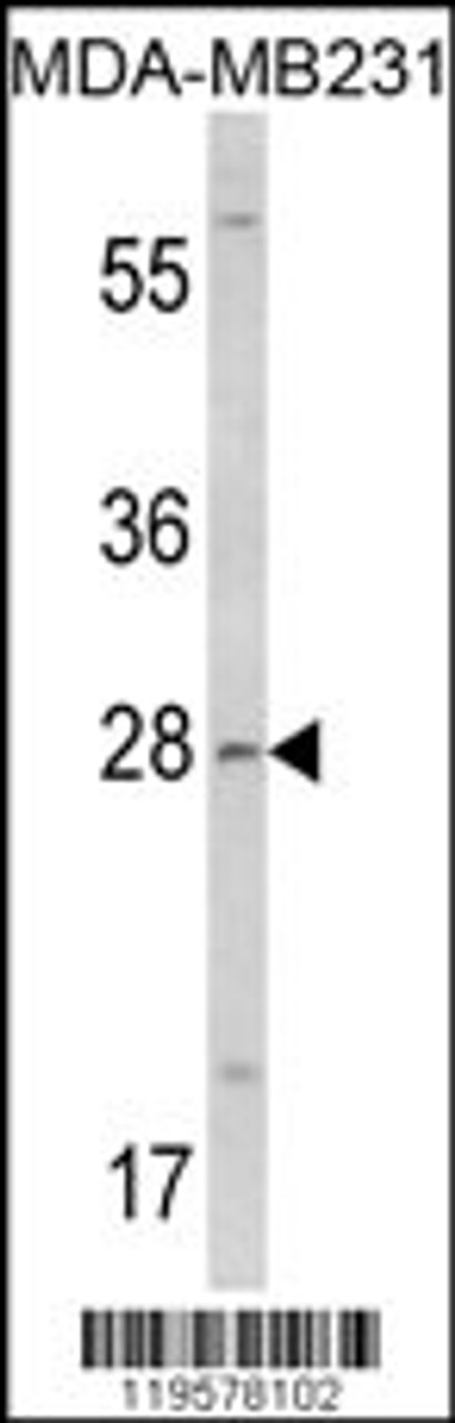 Western blot analysis of COLEC11 Antibody in MDA-MB231 cell line lysates (35ug/lane)
