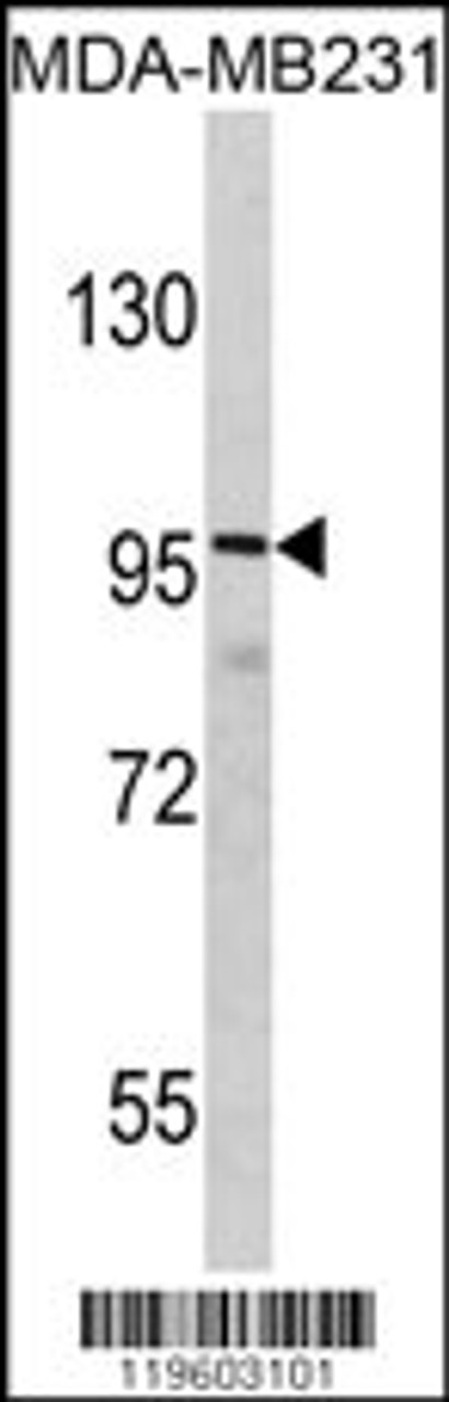 Western blot analysis of DLGAP1 Antibody in MDA-MB231 cell line lysates (35ug/lane)