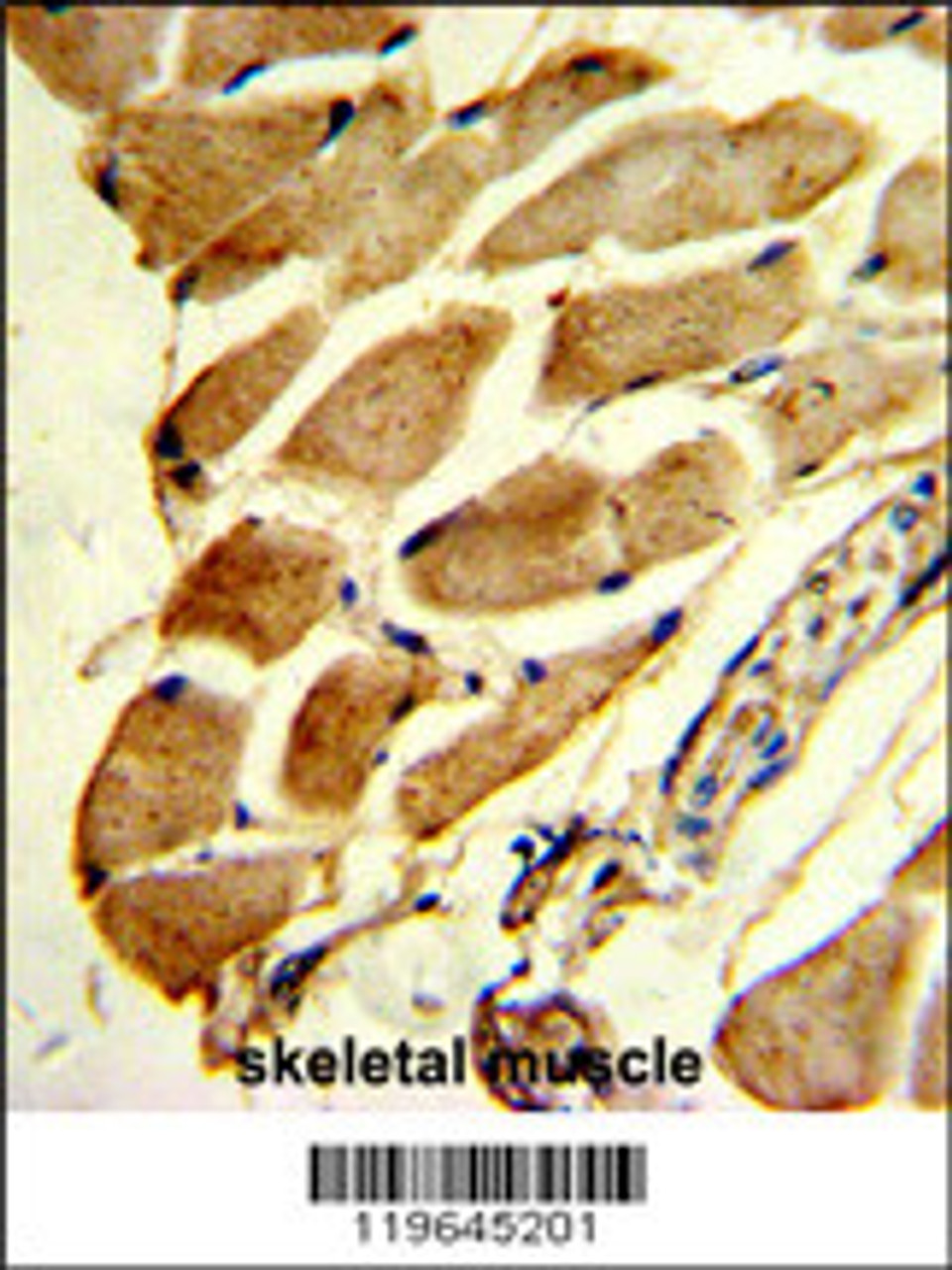 Formalin-fixed and paraffin-embedded human skeletal muscle reacted with FHL1 Antibody, which was peroxidase-conjugated to the secondary antibody, followed by DAB staining.