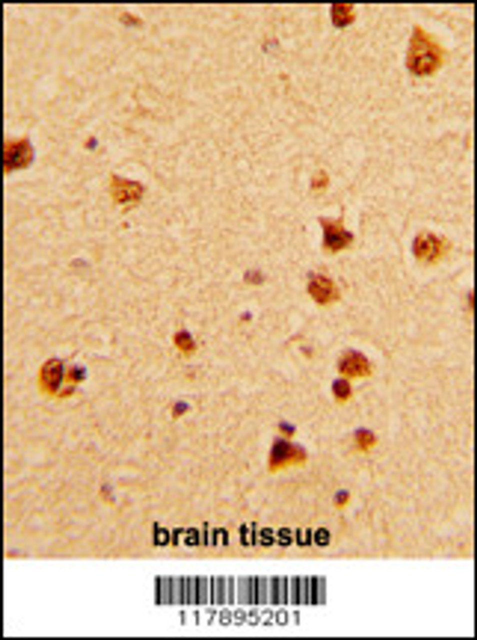 Formalin-fixed and paraffin-embedded human brain with KHSRP Antibody (N-term) , which was peroxidase-conjugated to the secondary antibody, followed by DAB staining.