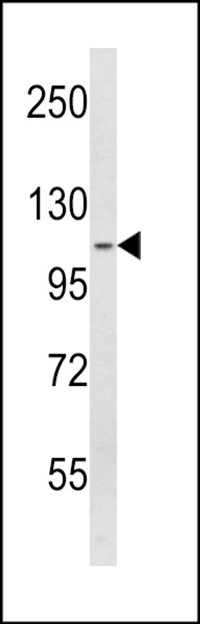 Western blot analysis of SPINK5 Antibody in A2058 cell line lysates (35ug/lane)