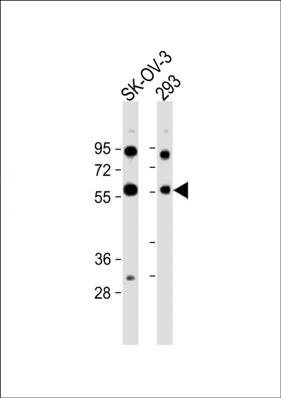 Western Blot at 1:1000 dilution Lane 1: SK-OV-3 whole cell lysate Lane 2: 293 whole cell lysate Lysates/proteins at 20 ug per lane.