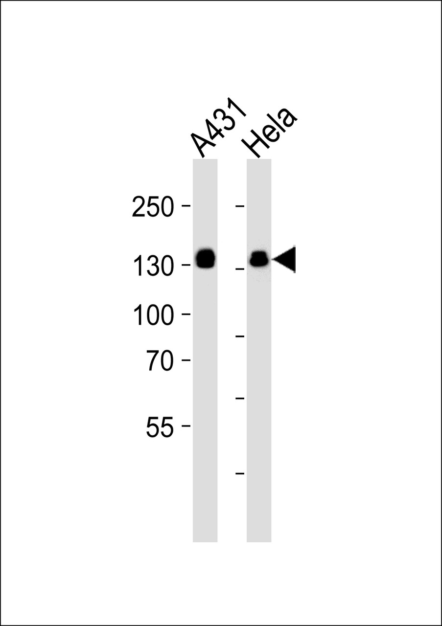 Western blot analysis of lysates from A431, Hela cell line (from left to right) , using GTF2I Antibody at 1:1000 at each lane.