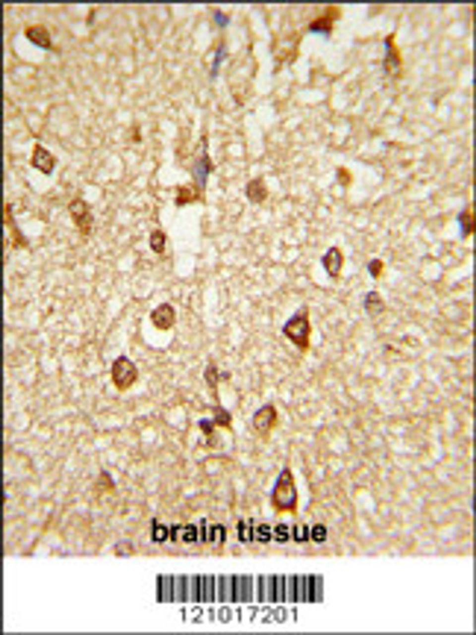 Formalin-fixed and paraffin-embedded human brain tissue reacted with DLX2 Antibody, which was peroxidase-conjugated to the secondary antibody, followed by DAB staining.